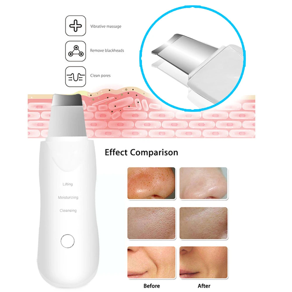 Vibration Face Skin Scrubber Blackhead Remover Facial Pore Cleaner Face Lifting Deep Clean Face Skin Tool Vibration Face Spatula
